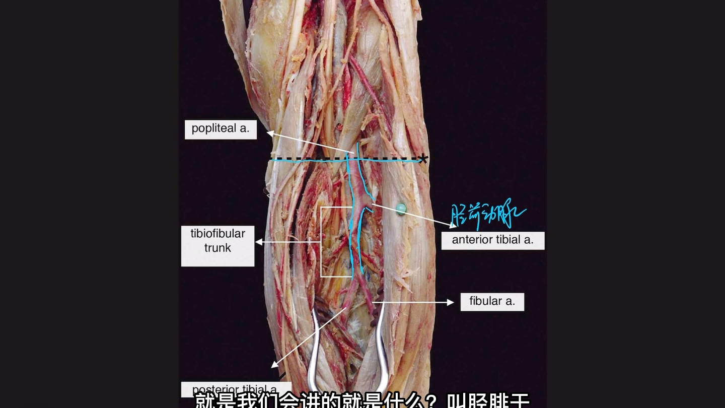 腘动脉的精细解剖【你绝对会漏掉一个分支】哔哩哔哩bilibili