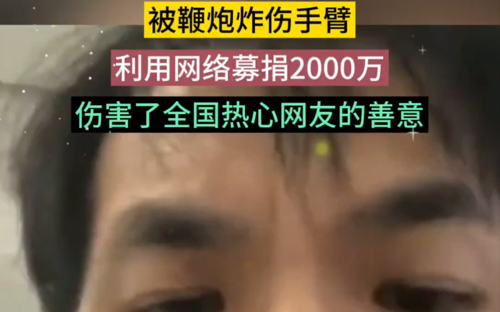 鞭炮炸伤手臂,利用网络募捐2000万,伤害了全国热心网友的善意!哔哩哔哩bilibili