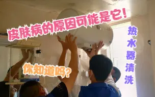 Скачать видео: 你家的热水器用多久了？清洗过吗？你的有些皮肤病也许另有原因！