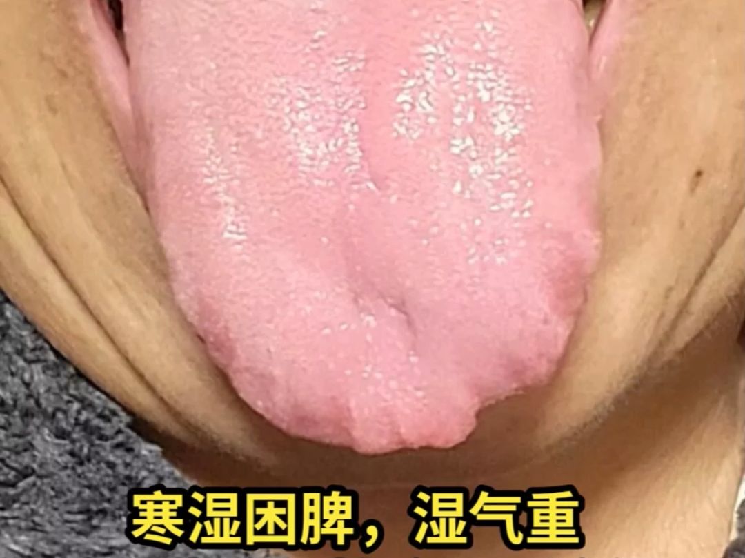 脾虛寒溼,腎精虧虛,氣血不足,溼熱下注