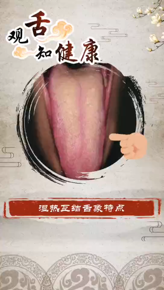 湿热互结会引发什么疾病呢哔哩哔哩bilibili