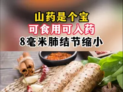 Tải video: 山药是个宝，可食用可入药，8毫米肺结节缩小，究竟是怎么办到的？