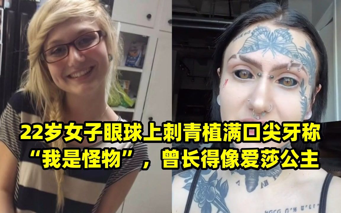 22岁女子眼球上刺青植满口尖牙称“我是怪物”,曾长得像爱莎公主哔哩哔哩bilibili