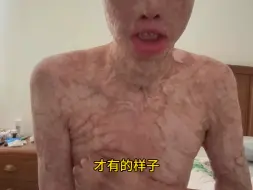 Download Video: 水火无情，人间有爱，感谢善良的大家让我重燃生活的希望。