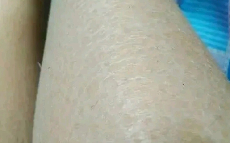 蛇皮肤#鱼鳞皮肤