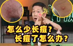 Descargar video: 怎么少长痘？怎么消痘快？教你最简单的祛痘方法！【老爸评测】