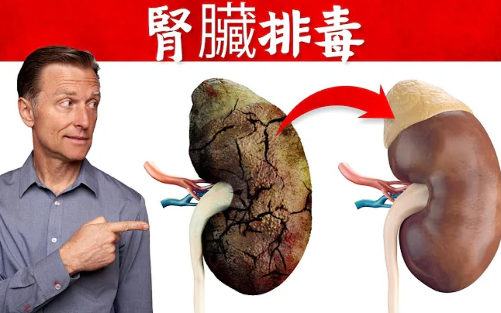 berg】肾脏排毒大揭秘!加速肾脏排毒,健康饮食指南!