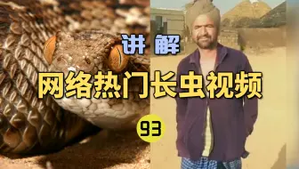 网络热门长虫视频(93)男子被锯鳞蝰咬伤在医院躺了4天！刚出院又被锯鳞蝰咬伤？最终不治身亡！