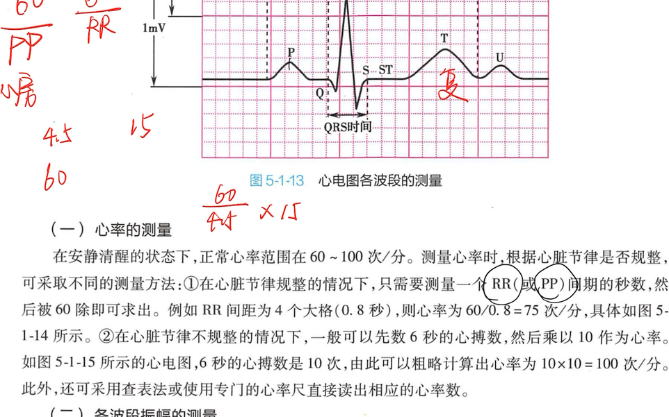 心电图的测量——心率、各波段振幅、各波段时间、平均心电轴、心脏循长轴转位哔哩哔哩bilibili