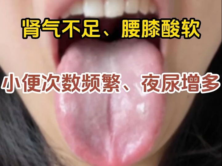 舌诊分析图,肾气不足,腰膝酸软哔哩哔哩bilibili