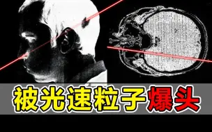 Download Video: 被光速粒子爆头！却奇迹生还！他成为了最不可能幸存的幸存者