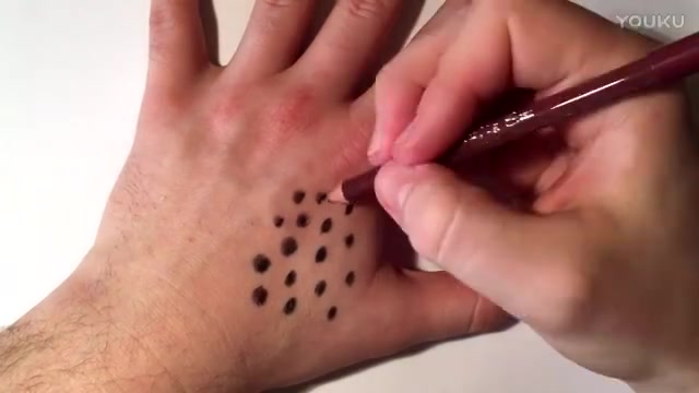 蜂窝手密集恐惧症慎重