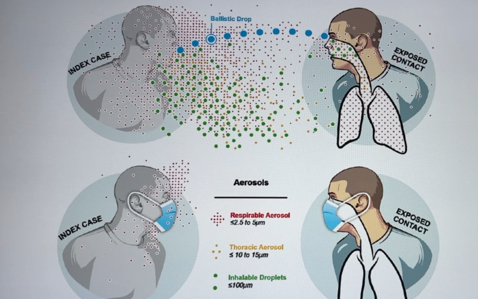 【奥密克戎导致新冠肺炎可能与吸入的颗粒物大小有关】所以你会戴口罩