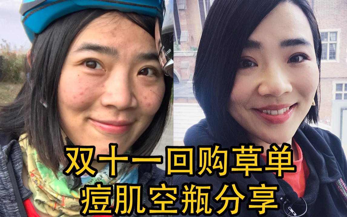 【童姥姥美】我是如何治好烂脸的?最有效方法,回购产品list,不到100的祛痘印精华.哔哩哔哩bilibili