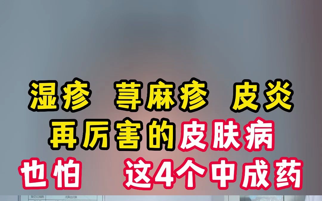 湿疹,荨麻疹,皮炎,再厉害的皮肤病,也怕这4个中成药哔哩哔哩bilibili