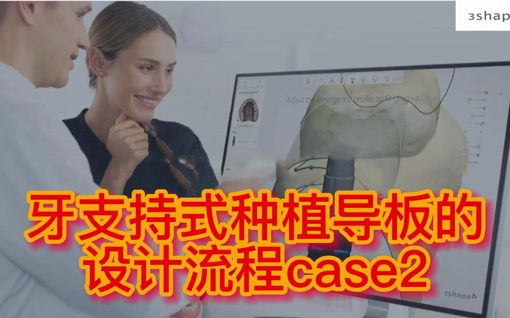 牙支持式种植导板的设计流程case2哔哩哔哩bilibili