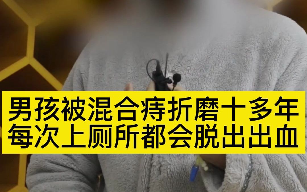 男孩被混合痔折磨十多年,每次上廁所都會脫出出血.