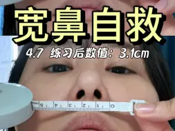 Video herunterladen: 大鼻头必看！亲测打卡一周！鼻翼竟然真的小了