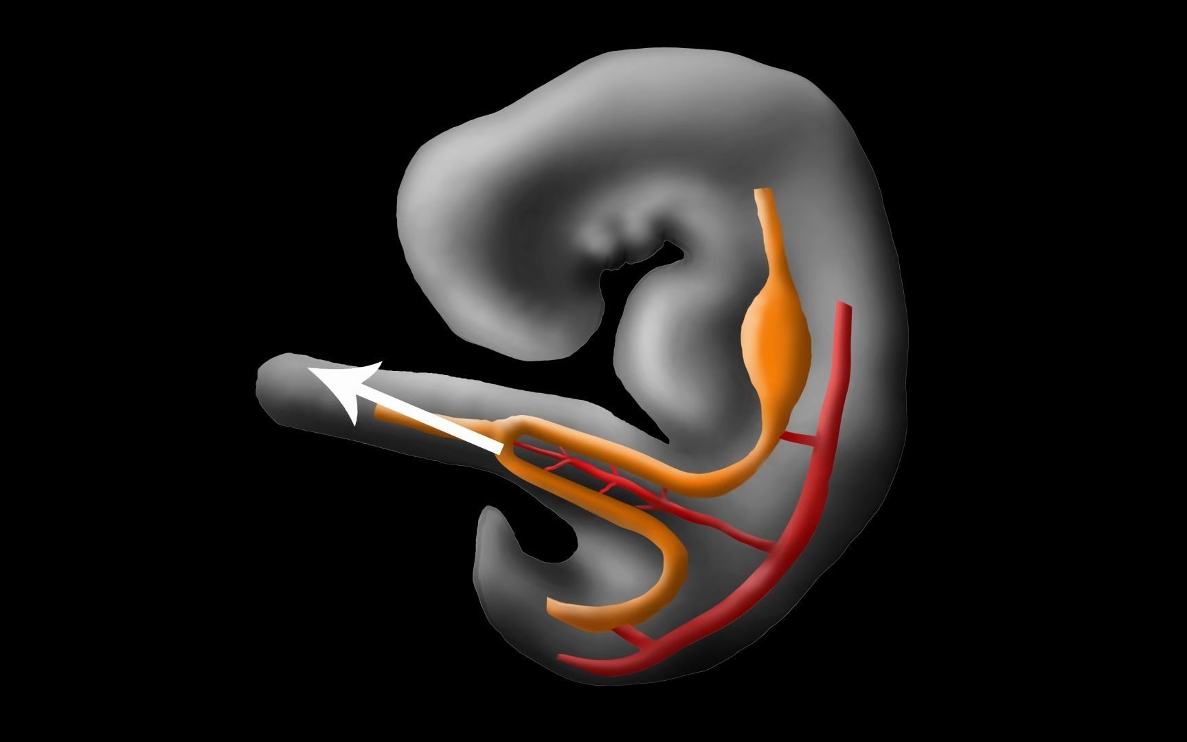 胚胎发育之肠管旋转(另一个版本)