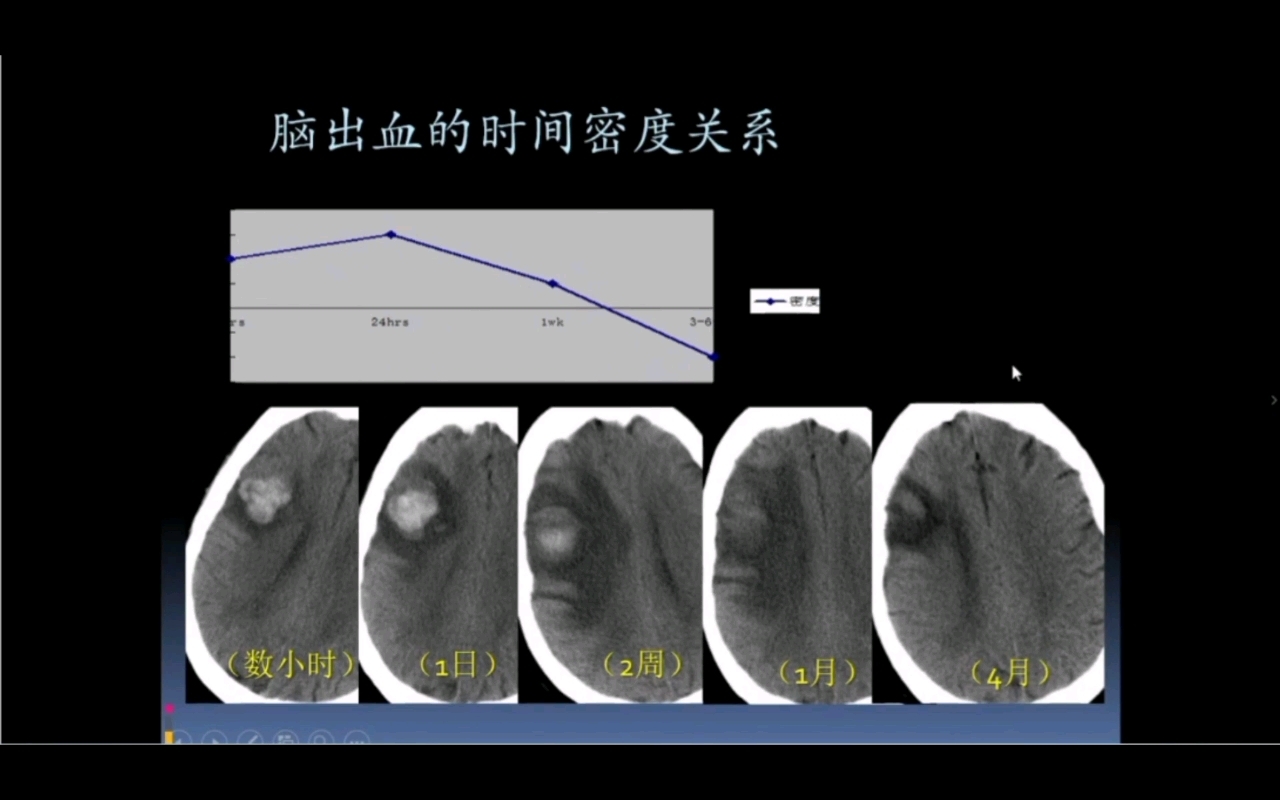 [图]神经系统影像基本知识