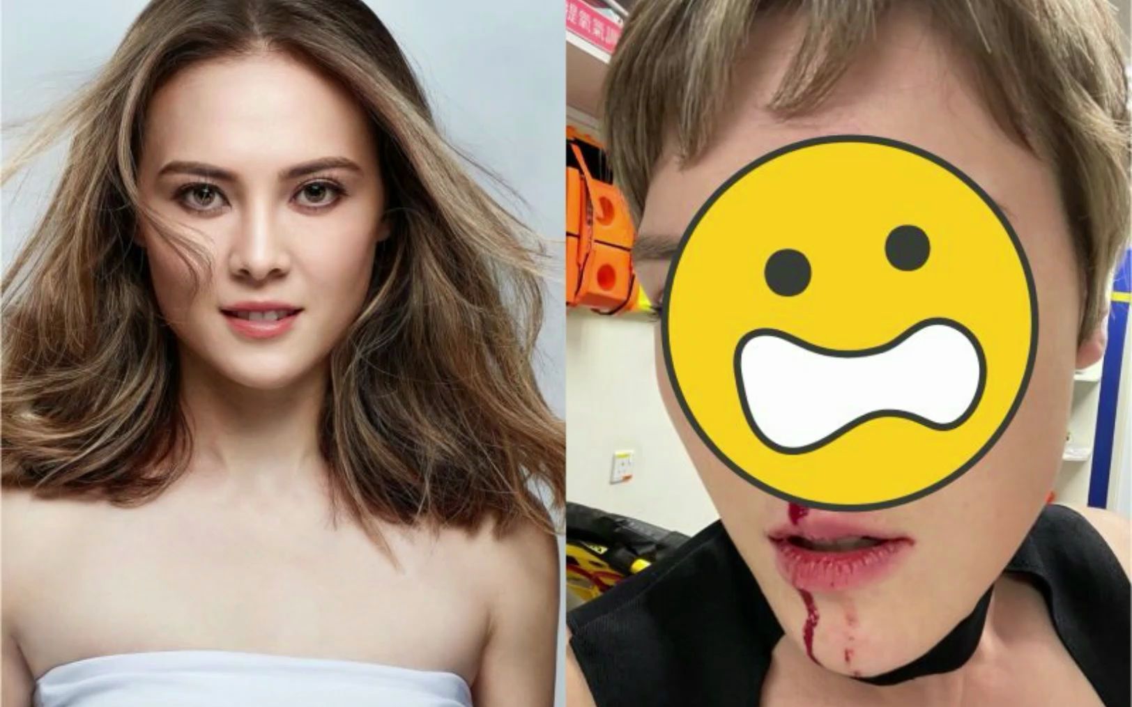 女星拍戏头撞玻璃"血流到下巴" 缝8针惊人画面曝光