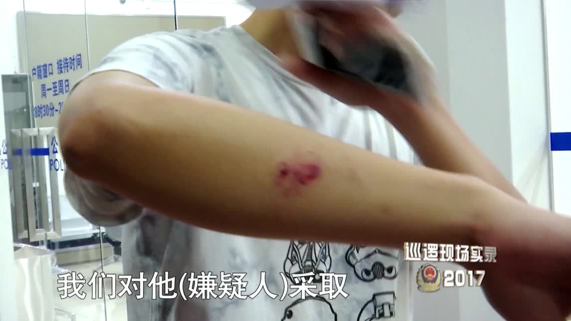 【巡逻现场实录2017】看点2-1：吸毒犯突然发狂咬住民警手臂！