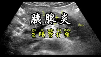 Download Video: 胰腺炎主胰管扩长张