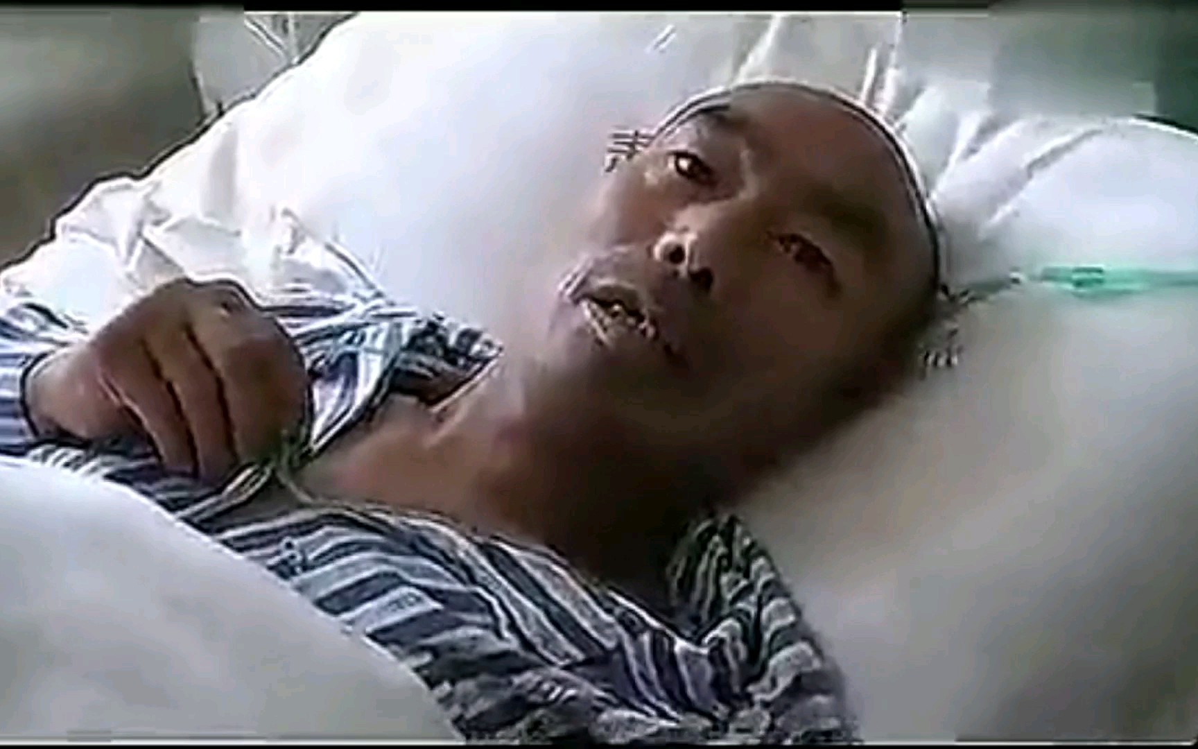 老人被割蛋听着就痛