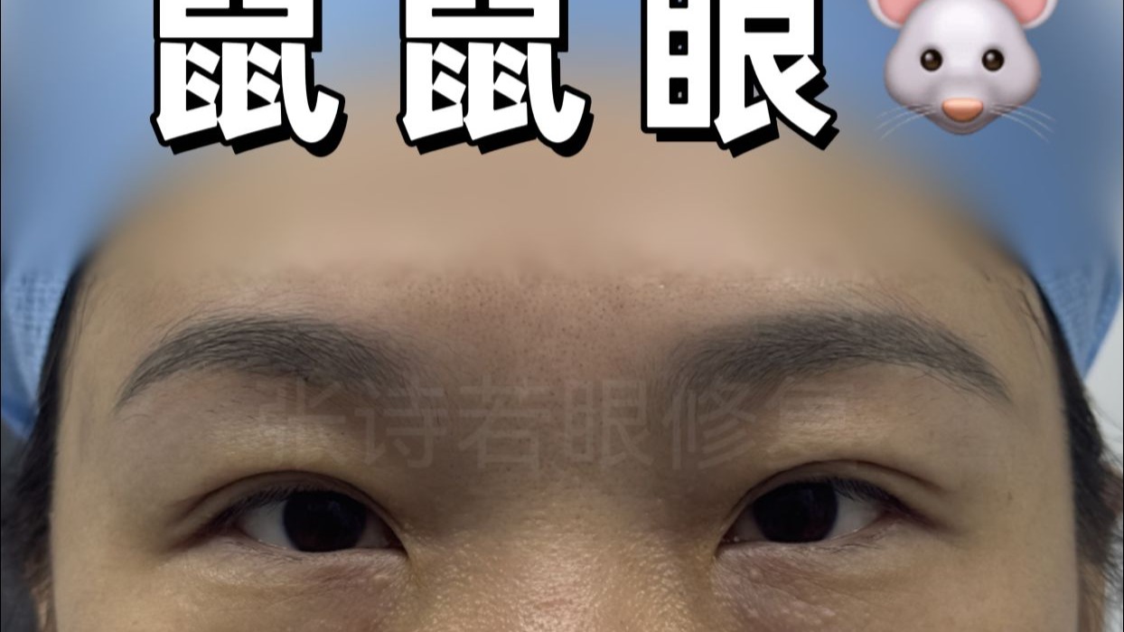 鼠鼠眼逆袭鹿鹿眼