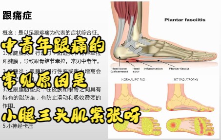 慢性运动系统疾病跟痛症哔哩哔哩bilibili