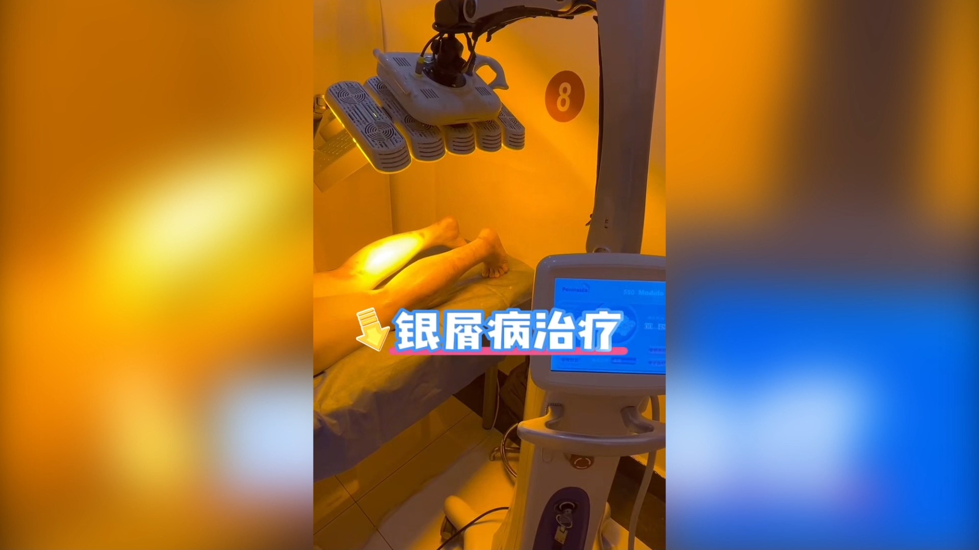 苏州肤康医院植发(苏州肤康医院植发价格)