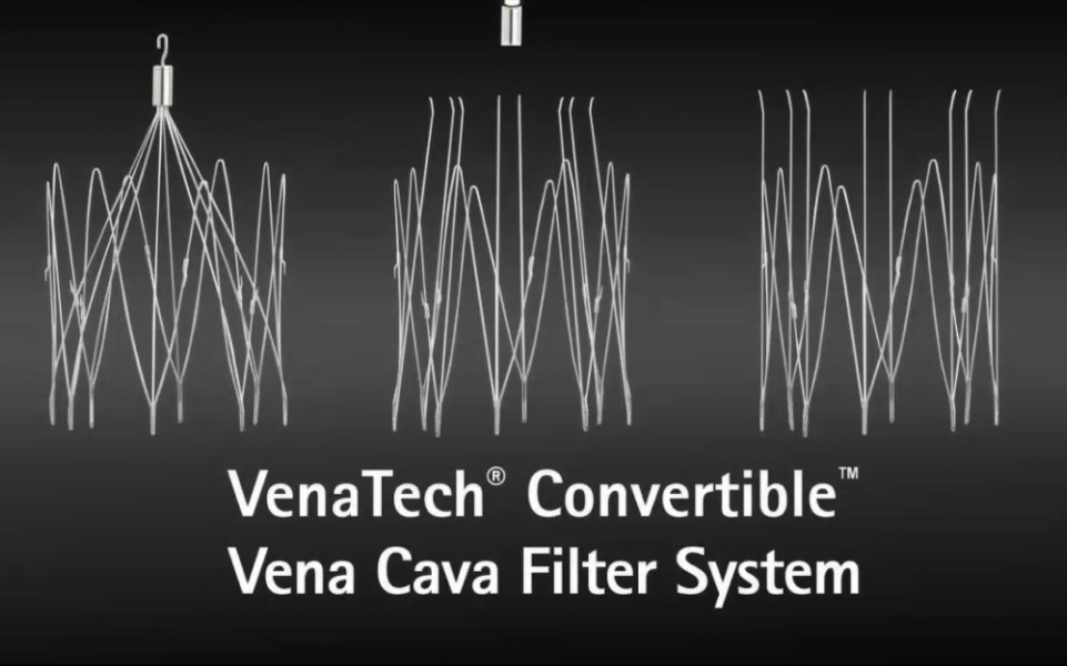 【转载】—医疗器械—贝朗—腔静脉滤器—中英文哔哩哔哩bilibili