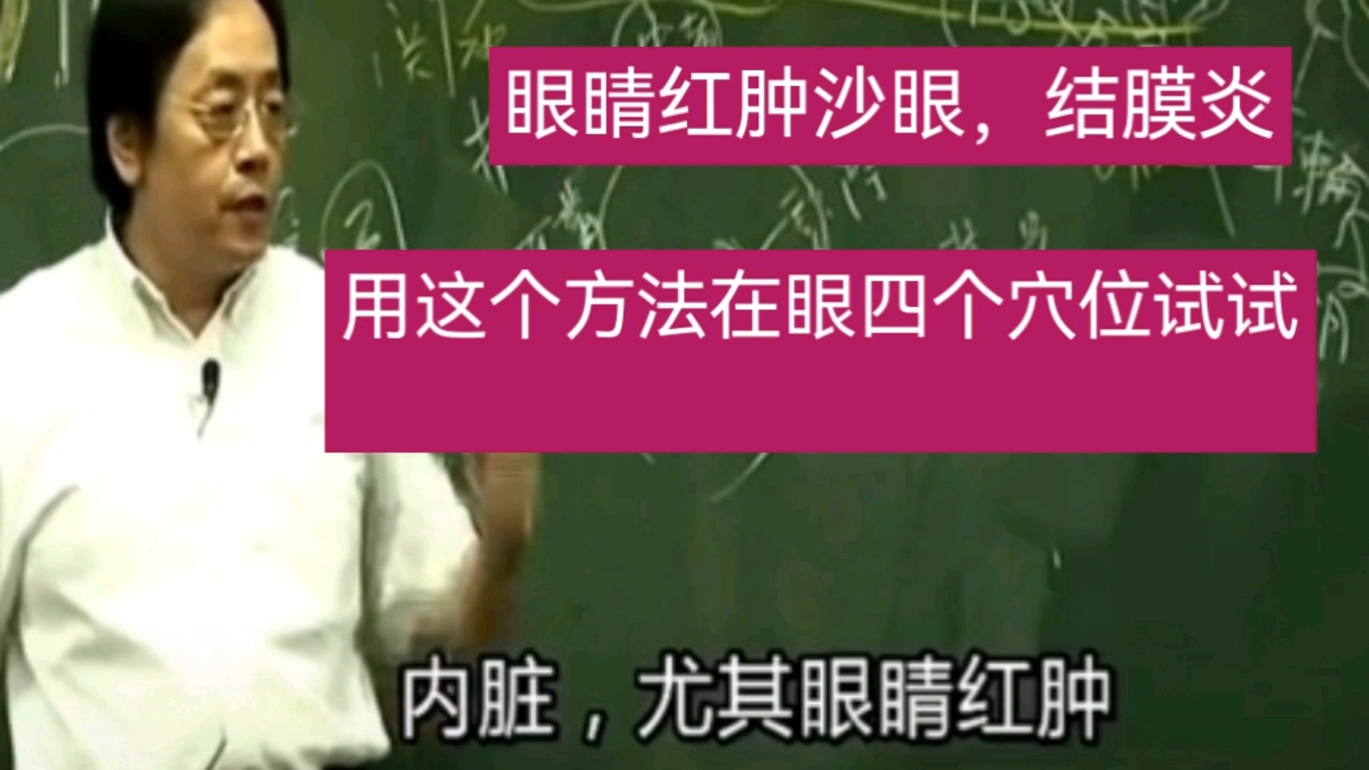 沙眼,眼睛红肿,结膜炎在这四个穴位放血试试吧,特管用哔哩哔哩bilibili