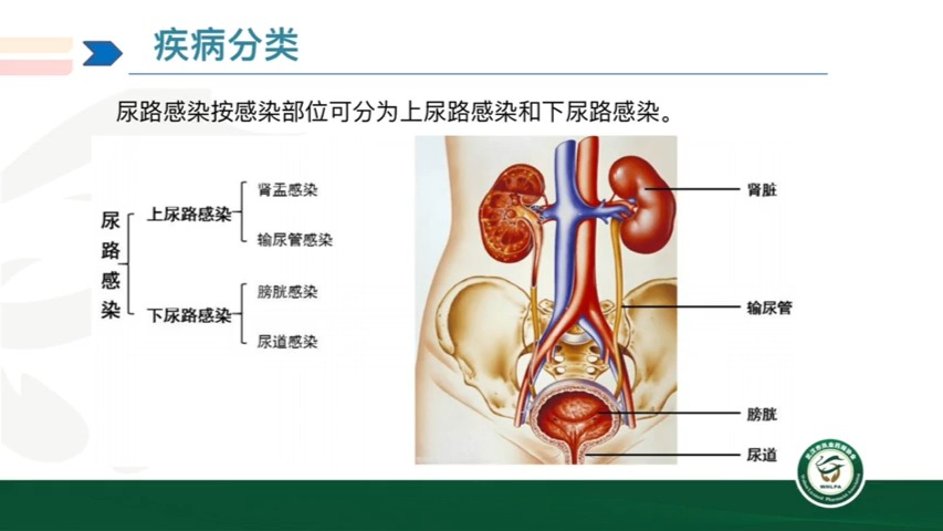 泌尿系感染药物治疗