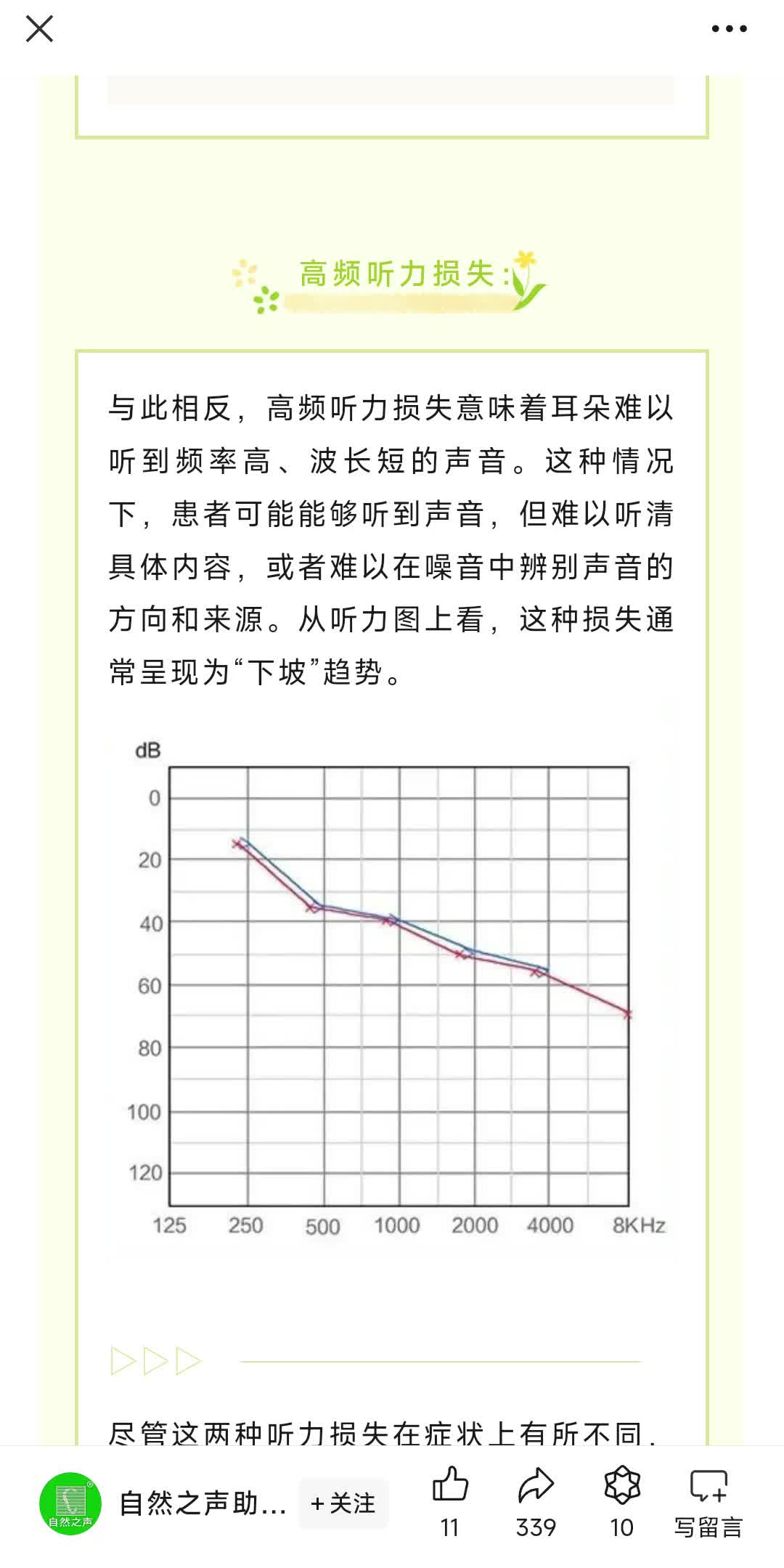 听力损失并非一概并论,高频低频虽然一字之差,但他们的症状和影响却是截然不同.点击阅读文章带您一起了解哔哩哔哩bilibili