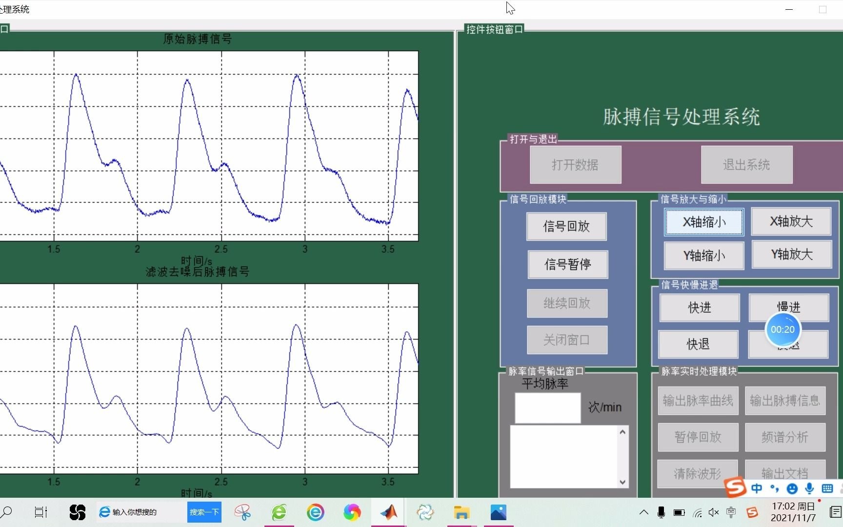 【肌电信号】基于matlab GUI脉搏信号处理系统【含Matlab源码 1062期】哔哩哔哩bilibili