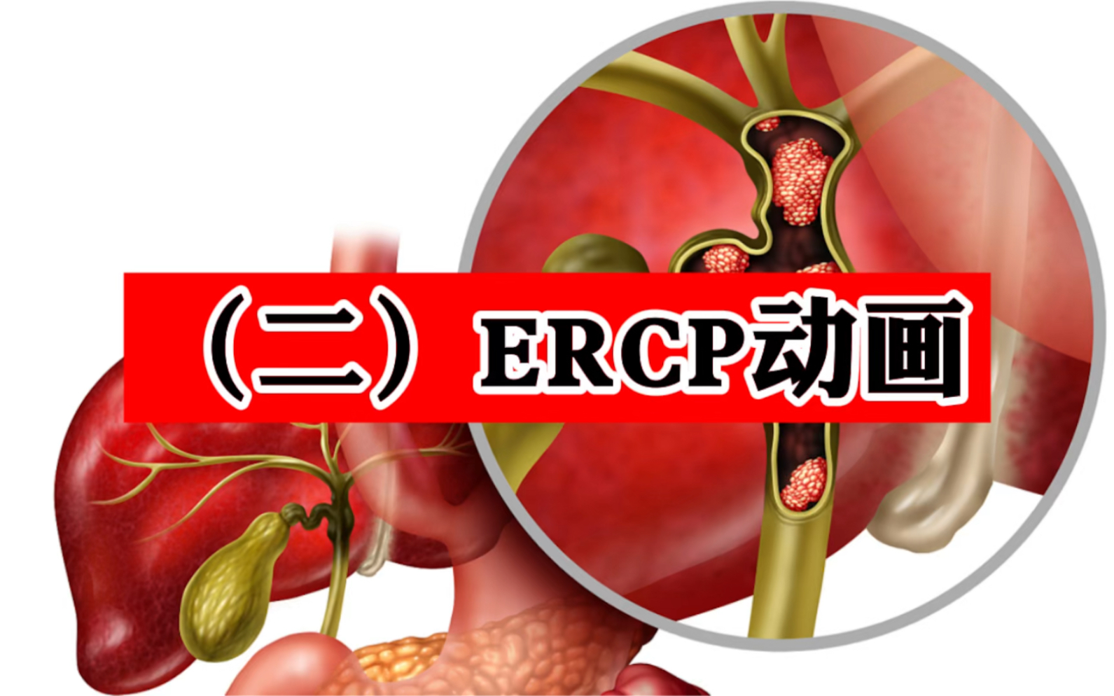 (二)ercp动画_哔哩哔哩_bilibili