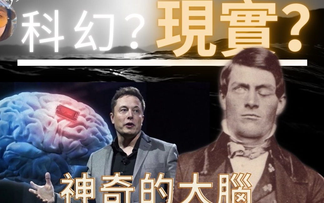 【震惊】被爆头奇蹟生还是什麽体验|一起来探索人脑|马斯克Neuralink是人类未来趋势还是大忽悠?【心理学奇闻】【Stella Says】哔哩哔哩bilibili