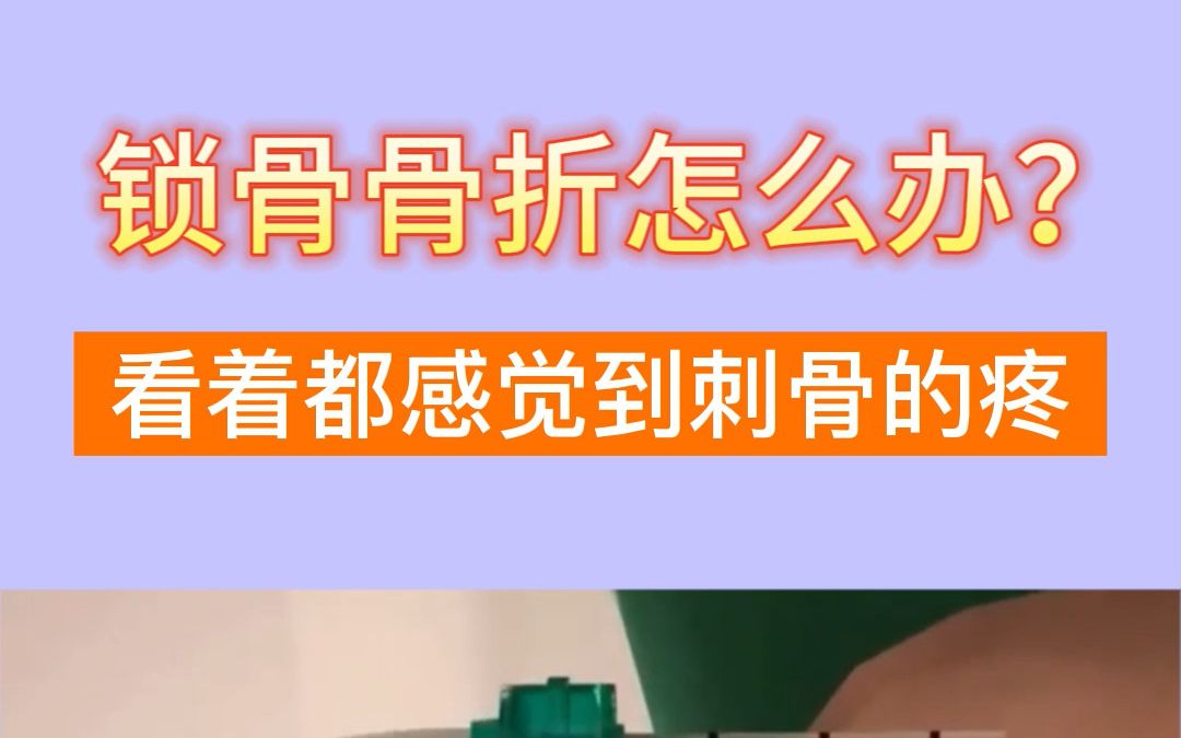 锁骨骨折固定手术