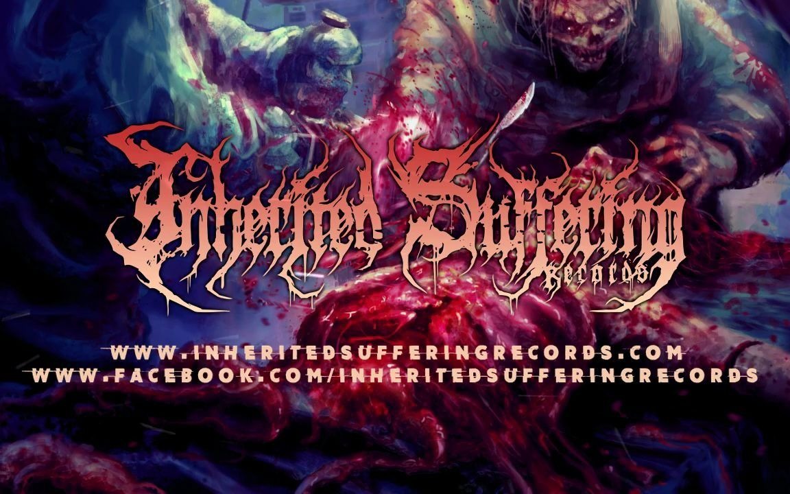 法国残酷死亡金属cryogenicalexcisionchronicallyimplanted