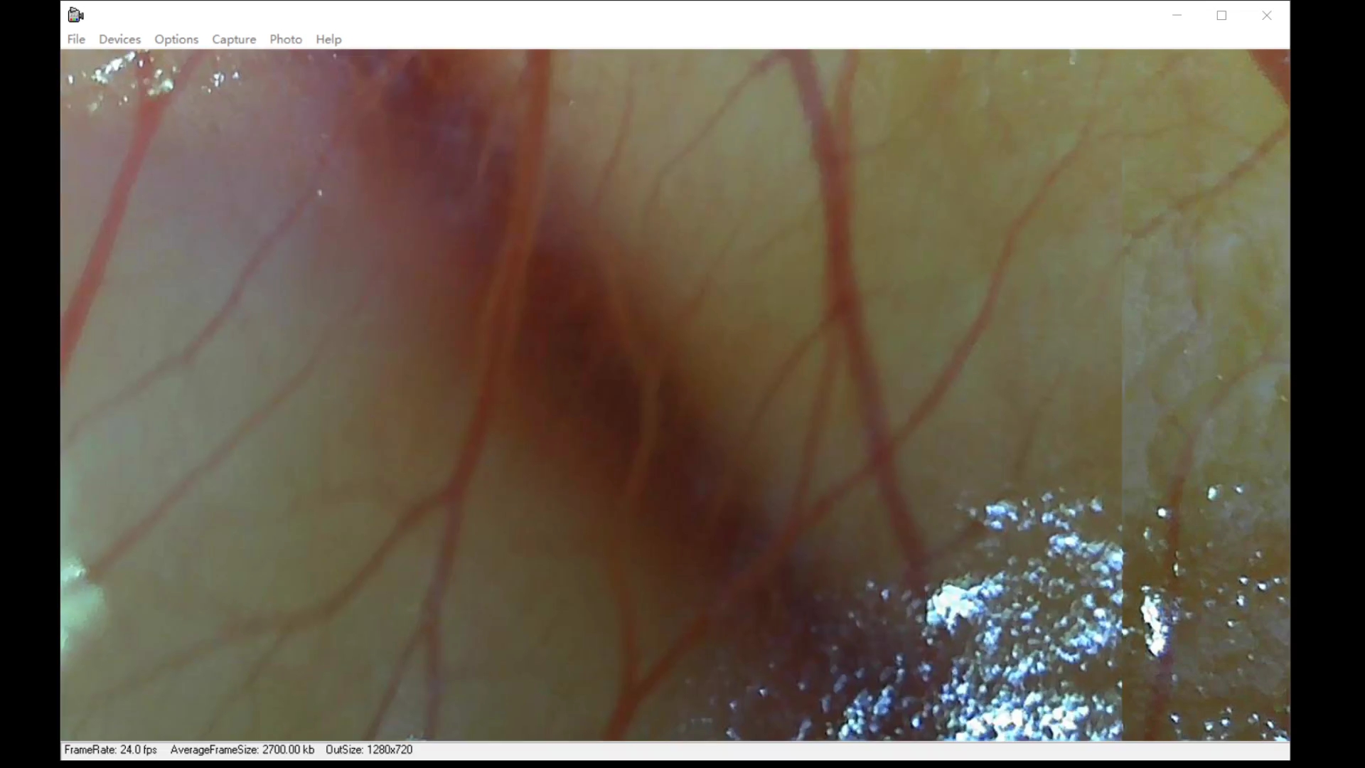 化妆品眼刺激性测试鸡胚绒毛尿囊膜实验(hetCAM)SLS(十二烷基硫酸钠)5.0%强刺激性对照哔哩哔哩bilibili