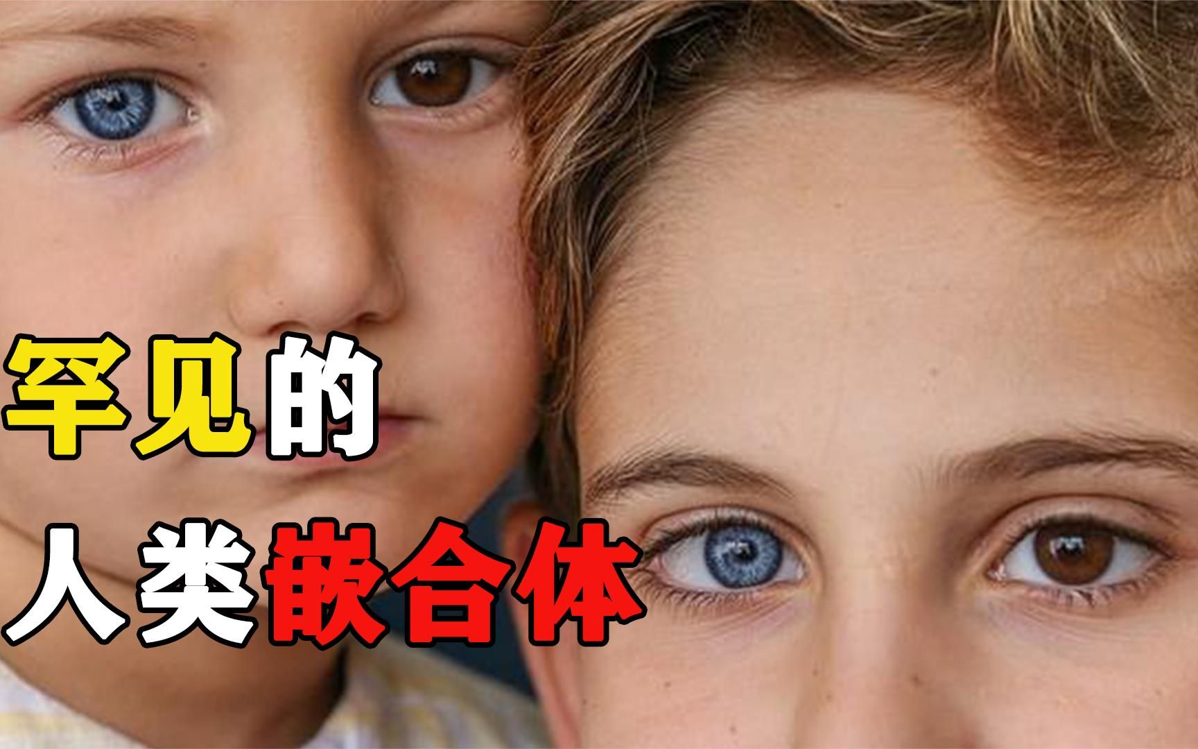 人体诡异的奇美拉现象,你的身体里,可能住着另一个人?