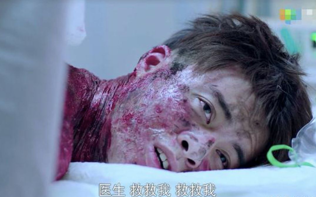 急诊科医生小伙为救女孩全身烧伤临死前说好后悔该救吗
