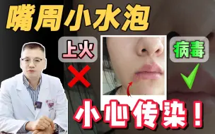 Download Video: 【科普】嘴巴周围长一簇簇小水泡，这可不是上火，而是病毒在作怪！