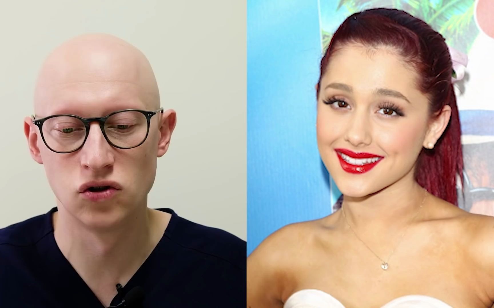 【双语】a妹无效换头?整容医生来分析!