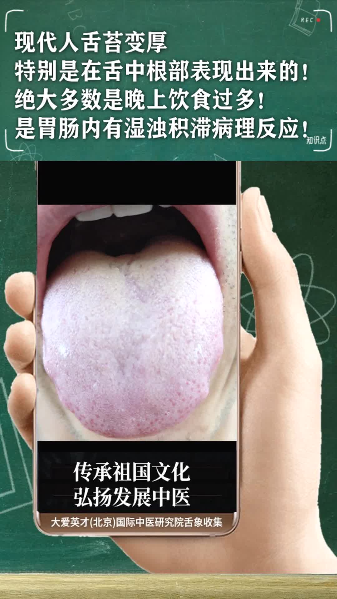 舌象分析舌苔白腻转为黄腻苔提示有肝病阳虚强心潜阳