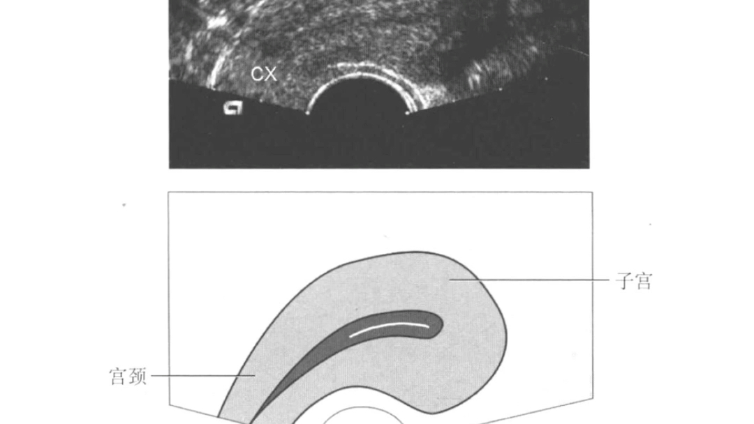 [图]超声标准切面图解