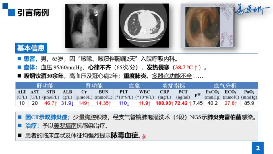 【讲解版】脓毒血症简要解读及其抗生素使用注意哔哩哔哩bilibili