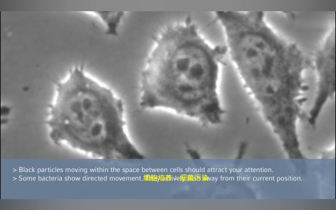 细胞培养翻车现场:黑胶虫,支原体,细菌污染合集