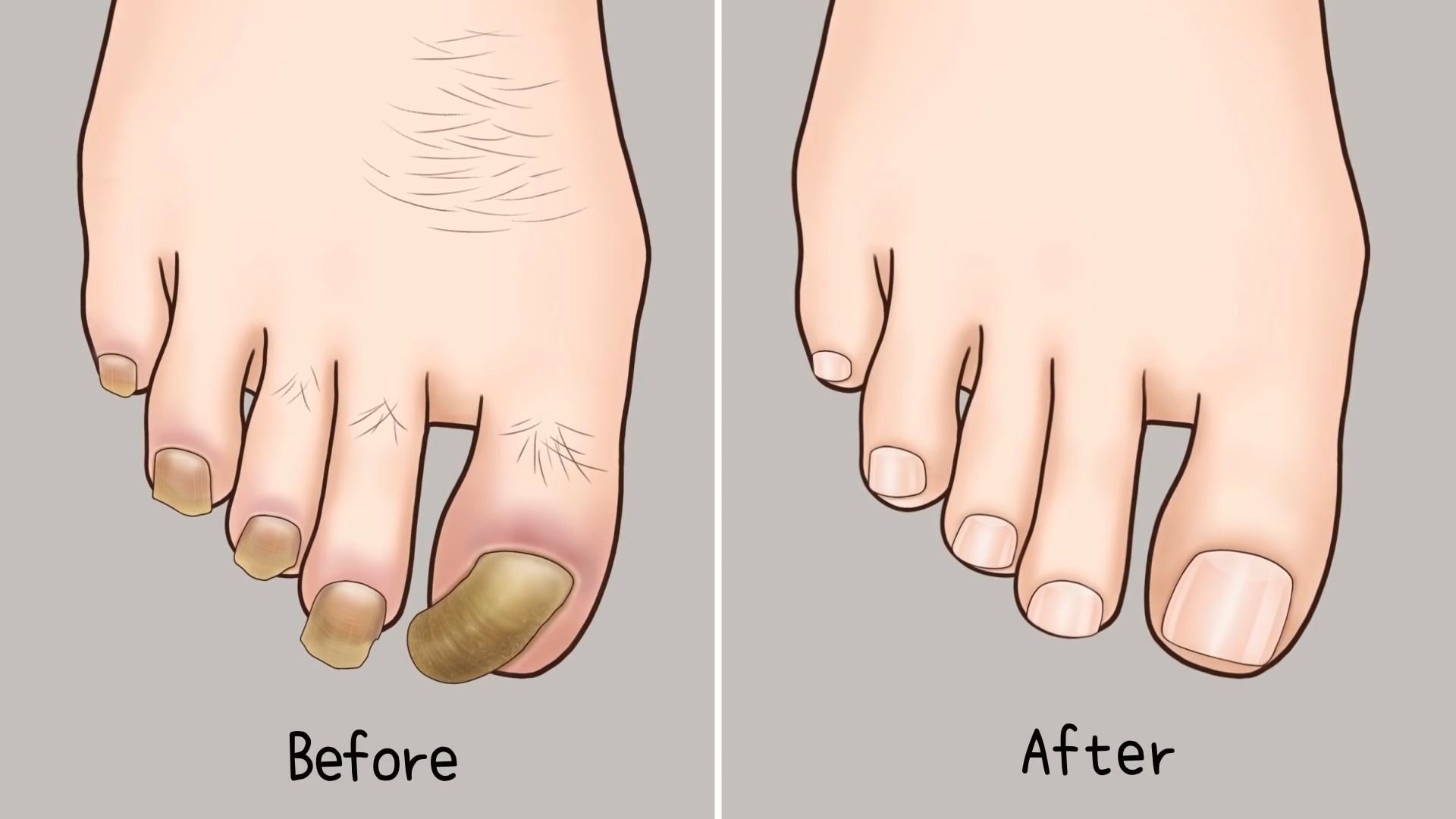 【smile bam解压动画】asmr护理动画收藏2 _脚趾甲